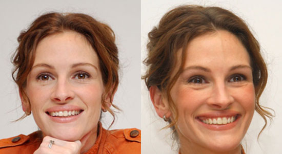 real-and-fake-smile-min